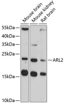 Western Blot: ARL2 Antibody [NBP3-38017] - Western blot analysis of various lysates using ARL2 Rabbit pAb at 1:3000 dilution.Secondary antibody: HRP-conjugated Goat anti-Rabbit IgG (H+L) at 1:10000 dilution.Lysates/proteins: 25ug per lane.Blocking buffer: 3% nonfat dry milk in TBST.Detection: ECL Enhanced Kit.Exposure time: 90s.