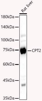 Western Blot: CPT2 Antibody [NBP3-38018] - Western blot analysis of lysates from Rat liver, using CPT2 Rabbit pAb at 1:500 dilution.Secondary antibody: HRP-conjugated Goat anti-Rabbit IgG (H+L) at 1:10000 dilution.Lysates/proteins: 25ug per lane.Blocking buffer: 3% nonfat dry milk in TBST.Detection: ECL Basic Kit.Exposure time: 180s.