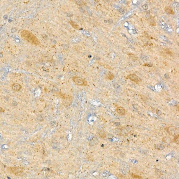 Immunohistochemistry: CPT2 Antibody [NBP3-38018] - Immunohistochemistry analysis of paraffin-embedded Rat brain using CPT2 Rabbit pAb at dilution of 1:50 (40x lens). High pressure antigen retrieval performed with 0.01M Citrate Bufferr (pH 6.0) prior to IHC staining.