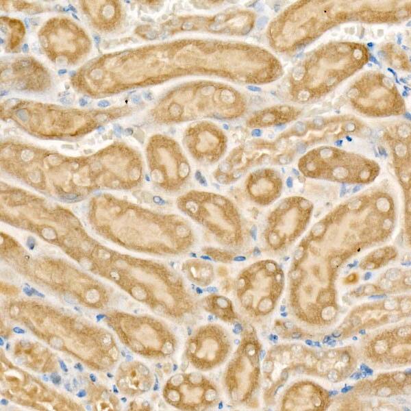 Immunohistochemistry: CPT2 Antibody [NBP3-38018] - Immunohistochemistry analysis of paraffin-embedded Mouse kidney using CPT2 Rabbit pAb at dilution of 1:50 (40x lens). High pressure antigen retrieval performed with 0.01M Citrate Bufferr (pH 6.0) prior to IHC staining.