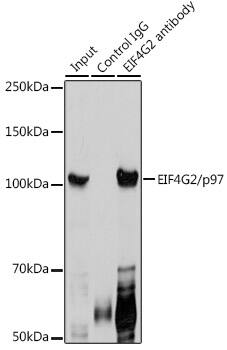 Immunoprecipitation: DAP5 Antibody [NBP3-38020] - Immunoprecipitation analysis of 300 ug extracts of HeLa cells using 3 ug DAP5 antibody. Western blot was performed from the immunoprecipitate using DAP5 antibody at a dilution of 1:1000.