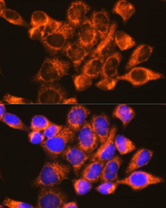 Immunocytochemistry/ Immunofluorescence: DAP5 Antibody [NBP3-38020] - Immunofluorescence analysis of HeLa cells using DAP5 Rabbit pAb at dilution of 1:100 (40x lens). Secondary antibody: Cy3-conjugated Goat anti-Rabbit IgG (H+L) at 1:500 dilution. Blue: DAPI for nuclear staining.