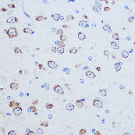 Immunohistochemistry: DAP5 Antibody [NBP3-38020] - Immunohistochemistry analysis of paraffin-embedded Mouse brain using DAP5 Rabbit pAb at dilution of 1:100 (40x lens). Microwave antigen retrieval performed with 0.01M Tris/EDTA Buffer (pH 9.0) prior to IHC staining.