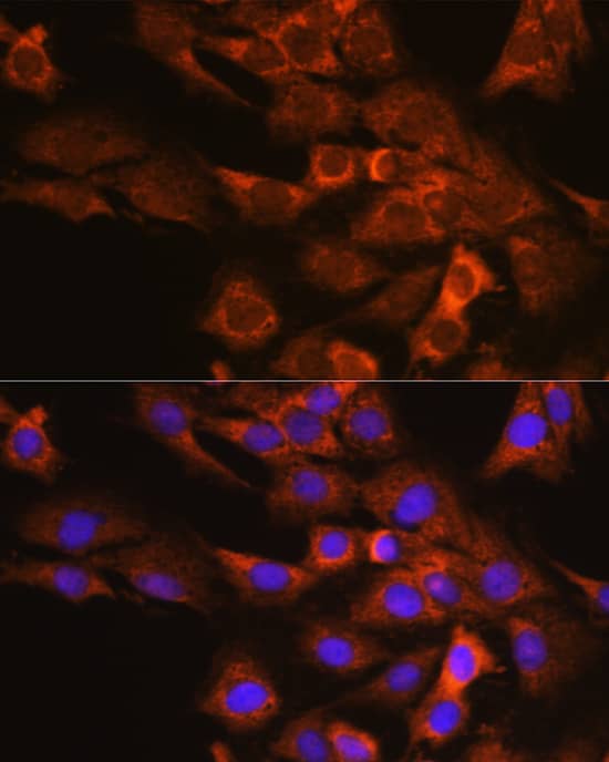 Immunocytochemistry/ Immunofluorescence: DAP5 Antibody [NBP3-38020] - Immunofluorescence analysis of C6 cells using DAP5 Rabbit pAb at dilution of 1:100 (40x lens). Secondary antibody: Cy3-conjugated Goat anti-Rabbit IgG (H+L) at 1:500 dilution. Blue: DAPI for nuclear staining.