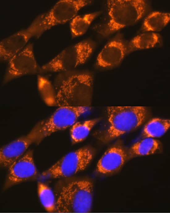 Immunocytochemistry/ Immunofluorescence: DAP5 Antibody [NBP3-38020] - Immunofluorescence analysis of NIH-3T3 cells using DAP5 Rabbit pAb at dilution of 1:100 (40x lens). Secondary antibody: Cy3-conjugated Goat anti-Rabbit IgG (H+L) at 1:500 dilution. Blue: DAPI for nuclear staining.