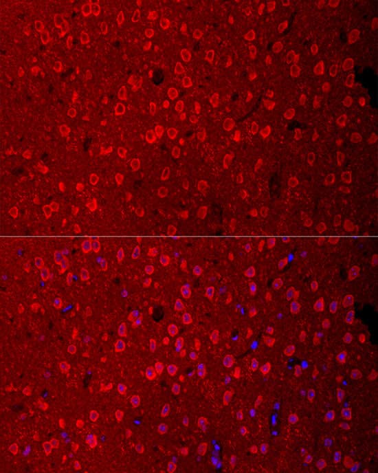 Immunohistochemistry: EAAT3 Antibody [NBP3-38021] - Perform microwave antigen retrieval with 10 mM citrate buffer pH 6.0 before commencing with IF staining protocol.Immunofluorescence analysis of paraffin-embedded mouse brain  using SLC1A1 Rabbit pAb at dilution of 1:400 (40x lens). Secondary antibody: Cy3-conjugated Goat anti-Rabbit IgG (H+L) at 1:500 dilution. Blue: DAPI for nuclear staining.