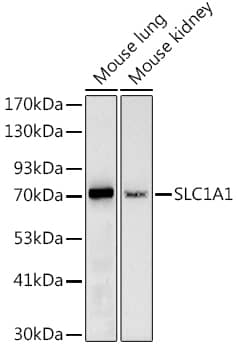 Western Blot: EAAT3 Antibody [NBP3-38021] - Western blot analysis of various lysates using  at 1:1000 dilution.Secondary antibody: HRP-conjugated Goat anti-Rabbit IgG (H+L) at 1:10000 dilution.Lysates/proteins: 25μg per lane.Blocking buffer: 3% nonfat dry milk in TBST.Detection: ECL Basic Kit.Exposure time: 180s.