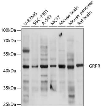 Western Blot: Gastrin-releasing Peptide R/GRPR Antibody [NBP3-38023] - Western blot analysis of various lysates using Gastrin-releasing Peptide R/GRPR Rabbit pAb at 1:3000 dilution.Secondary antibody: HRP-conjugated Goat anti-Rabbit IgG (H+L) at 1:10000 dilution.Lysates/proteins: 25ug per lane.Blocking buffer: 3% nonfat dry milk in TBST.Detection: ECL Basic Kit.Exposure time: 15s.