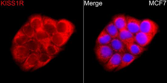 Immunocytochemistry/ Immunofluorescence: KiSS1R/GPR54 Antibody [NBP3-38024] - Immunofluorescence analysis of MCF7 cells using KiSS1R/GPR54 Rabbit pAbat a dilution of 1:150 (40x lens). Secondary antibody:Cy3 Goat Anti-Rabbit IgG (H+L)at 1:500 dilution. Blue: DAPI for nuclear staining.