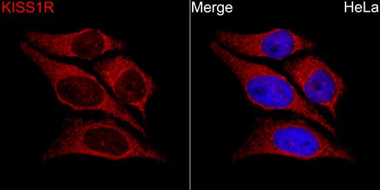 Immunocytochemistry/ Immunofluorescence: KiSS1R/GPR54 Antibody [NBP3-38024] - Immunofluorescence analysis of HeLa cells using KiSS1R/GPR54 Rabbit pAbat a dilution of 1:150 (40x lens). Secondary antibody:Cy3 Goat Anti-Rabbit IgG (H+L)at 1:500 dilution. Blue: DAPI for nuclear staining.