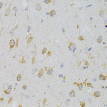 Immunohistochemistry: KiSS1R/GPR54 Antibody [NBP3-38024] - Immunohistochemistry analysis of paraffin-embedded Mouse brain using KiSS1R/GPR54 Rabbit pAb at dilution of 1:100 (40x lens). Microwave antigen retrieval performed with 0.01M PBS Buffer (pH 7.2) prior to IHC staining.