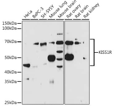 Western Blot: KiSS1R/GPR54 Antibody [NBP3-38024] - Western blot analysis of various lysates using KiSS1R/GPR54 Rabbit pAb at 1:1000 dilution.Secondary antibody: HRP-conjugated Goat anti-Rabbit IgG (H+L) at 1:10000 dilution.Lysates/proteins: 25ug per lane.Blocking buffer: 3% nonfat dry milk in TBST.Detection: ECL Basic Kit.Exposure time: 60s.