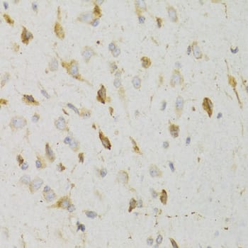 Immunohistochemistry: KiSS1R/GPR54 Antibody [NBP3-38024] - Immunohistochemistry analysis of paraffin-embedded Rat brain using KiSS1R/GPR54 Rabbit pAb at dilution of 1:100 (40x lens). Microwave antigen retrieval performed with 0.01M PBS Buffer (pH 7.2) prior to IHC staining.