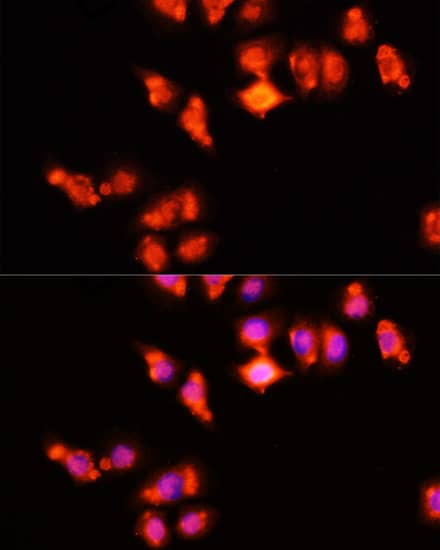 Immunocytochemistry/ Immunofluorescence: HOXA11 Antibody [NBP3-38025] - Immunofluorescence analysis of HeLa cells using HOXA11 Rabbit pAb at dilution of 1:100 (40x lens). Secondary antibody: Cy3-conjugated Goat anti-Rabbit IgG (H+L) at 1:500 dilution. Blue: DAPI for nuclear staining.