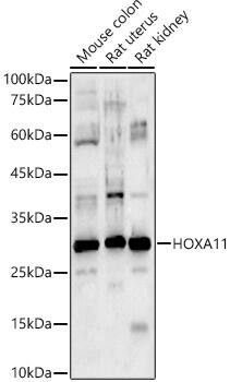 Western Blot: HOXA11 Antibody [NBP3-38025] - Western blot analysis of various lysates, using HOXA11 Rabbit pAb at 1:1000 dilution.Secondary antibody: HRP-conjugated Goat anti-Rabbit IgG (H+L) at 1:10000 dilution.Lysates/proteins: 25ug per lane.Blocking buffer: 3% nonfat dry milk in TBST.Detection: ECL Basic Kit.Exposure time: 60s.