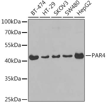 Western Blot: PAWR / PAR4 Antibody [NBP3-38026] - Western blot analysis of various lysates using PAWR / PAR4 Rabbit pAb at 1:400 dilution.Secondary antibody: HRP-conjugated Goat anti-Rabbit IgG (H+L) at 1:10000 dilution.Lysates/proteins: 25ug per lane.Blocking buffer: 3% nonfat dry milk in TBST.Detection: ECL Basic Kit.Exposure time: 30s.