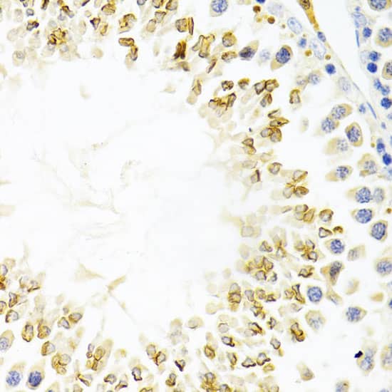 Immunohistochemistry: GEMIN2 Antibody [NBP3-38028] - Immunohistochemistry analysis of paraffin-embedded Mouse testis using GEMIN2 Rabbit pAb at dilution of 1:100 (40x lens). Microwave antigen retrieval performed with 0.01M PBS Buffer (pH 7.2) prior to IHC staining.