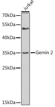 Western Blot: GEMIN2 Antibody [NBP3-38028] - Western blot analysis of lysates from Jurkat cells, using GEMIN2 Rabbit pAb at 1:500 dilution.Secondary antibody: HRP-conjugated Goat anti-Rabbit IgG (H+L) at 1:10000 dilution.Lysates/proteins: 25ug per lane.Blocking buffer: 3% nonfat dry milk in TBST.Detection: ECL Basic Kit.Exposure time: 90s.