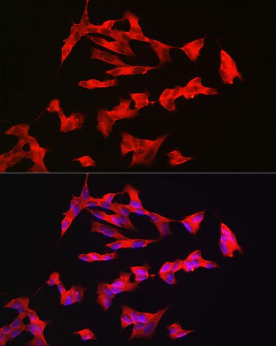 Immunocytochemistry/ Immunofluorescence PAC1R Antibody