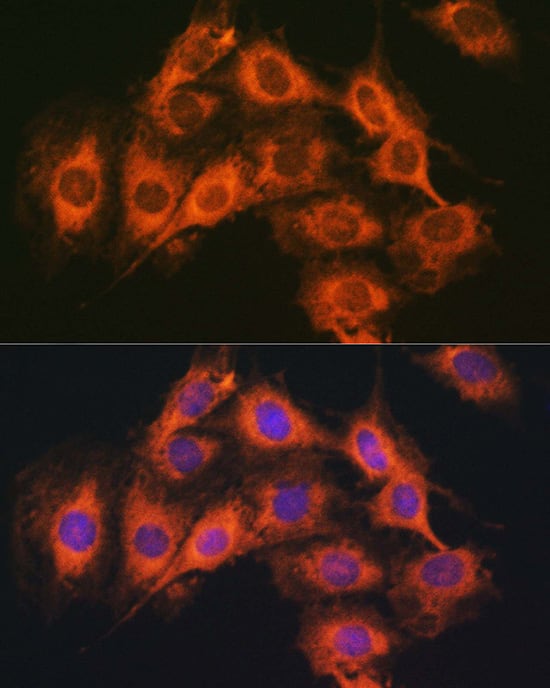 Immunocytochemistry/ Immunofluorescence PAC1R Antibody