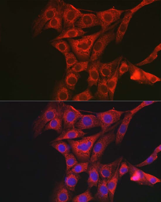 Immunocytochemistry/ Immunofluorescence: PAC1R Antibody [NBP3-38030] - Immunofluorescence analysis of NIH/3T3 cells using PAC1R Rabbit pAb at dilution of 1:100 (40x lens). Secondary antibody: Cy3-conjugated Goat anti-Rabbit IgG (H+L) at 1:500 dilution. Blue: DAPI for nuclear staining.