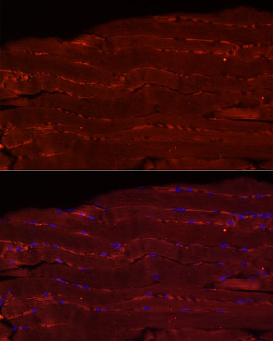 Immunocytochemistry/ Immunofluorescence: Fbx32 Antibody [NBP3-38033] - Immunofluorescence analysis of paraffin-embedded mouse skeletal muscle using Fbx32 Rabbit pAb at dilution of 1:20 (40x lens). Secondary antibody: Cy3-conjugated Goat anti-Rabbit IgG (H+L) at 1:500 dilution. Blue: DAPI for nuclear staining.