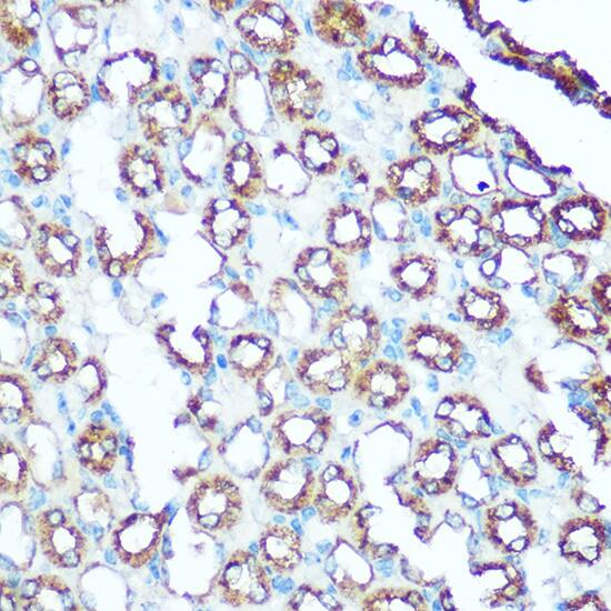 Immunohistochemistry: UQCRC1 Antibody [NBP3-38038] - Immunohistochemistry analysis of paraffin-embedded Mouse kidney using UQCRC1 Rabbit pAb at dilution of 1:100 (40x lens). Microwave antigen retrieval performed with 0.01M Tris/EDTA Buffer (pH 9.0) prior to IHC staining.