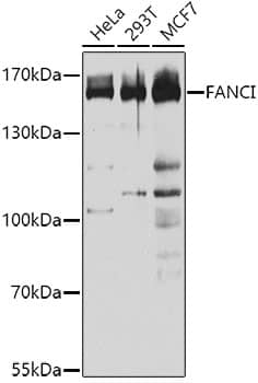 Western Blot: FANCI Antibody [NBP3-38040] - Western blot analysis of various lysates using FANCI Rabbit pAb at 1:1000 dilution.Secondary antibody: HRP-conjugated Goat anti-Rabbit IgG (H+L) at 1:10000 dilution.Lysates/proteins: 25ug per lane.Blocking buffer: 3% nonfat dry milk in TBST.Detection: ECL Basic Kit.Exposure time: 10s.