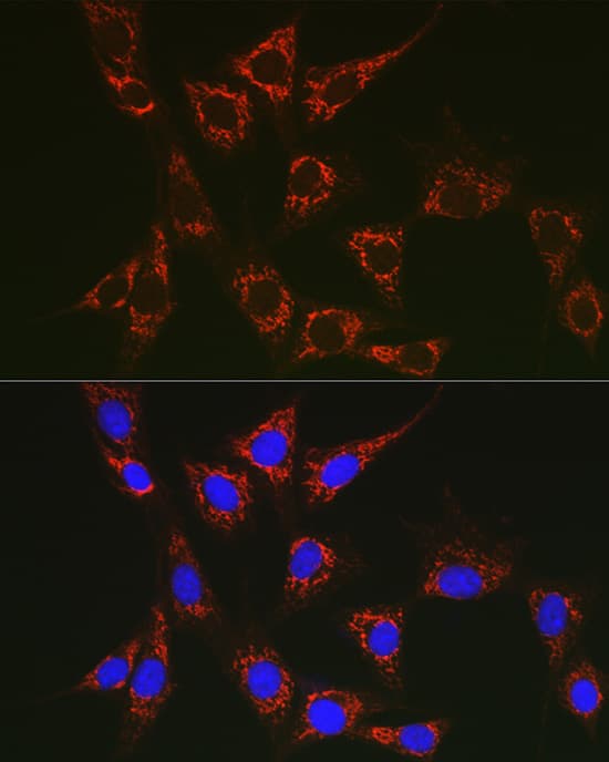 Immunocytochemistry/ Immunofluorescence: SLC25A6 Antibody [NBP3-38043] - Immunofluorescence analysis of NIH/3T3 cells using SLC25A6 Rabbit pAb at dilution of 1:100 (40x lens). Secondary antibody: Cy3-conjugated Goat anti-Rabbit IgG (H+L) at 1:500 dilution. Blue: DAPI for nuclear staining.