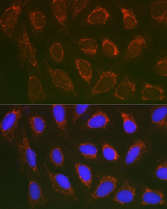 Immunocytochemistry/ Immunofluorescence: SLC25A6 Antibody [NBP3-38043] - Immunofluorescence analysis of U2OS cells using SLC25A6 Rabbit pAb at dilution of 1:100 (40x lens). Secondary antibody: Cy3-conjugated Goat anti-Rabbit IgG (H+L) at 1:500 dilution. Blue: DAPI for nuclear staining.