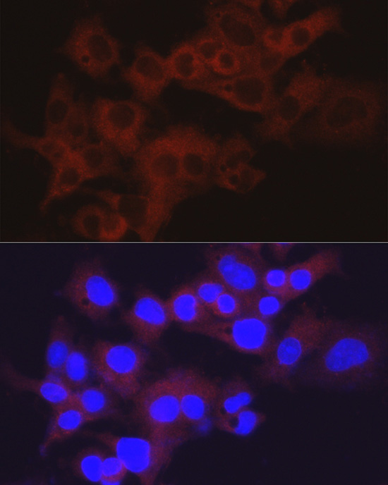 Immunocytochemistry/ Immunofluorescence: Aldolase B Antibody [NBP3-38045] - Immunofluorescence analysis of HepG2 cells using Aldolase B Rabbit pAb at dilution of 1:50 (40x lens). Blue: DAPI for nuclear staining.