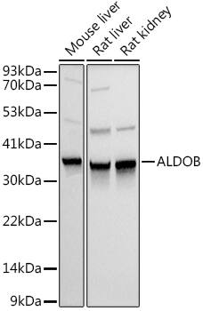 Western Blot: Aldolase B Antibody [NBP3-38045] - Western blot analysis of various lysates using Aldolase B Rabbit pAb at 1:1000 dilution.Secondary antibody: HRP-conjugated Goat anti-Rabbit IgG (H+L) at 1:10000 dilution.Lysates/proteins: 25ug per lane.Blocking buffer: 3% nonfat dry milk in TBST.Detection: ECL Basic Kit.Exposure time: 1s.