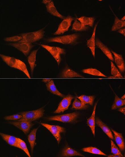 Immunocytochemistry/ Immunofluorescence: Aldolase B Antibody [NBP3-38045] - Immunofluorescence analysis of NIH/3T3 cells using Aldolase B Rabbit pAb at dilution of 1:100. Secondary antibody: Cy3-conjugated Goat anti-Rabbit IgG (H+L) at 1:500 dilution. Blue: DAPI for nuclear staining.