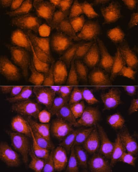 Immunocytochemistry/ Immunofluorescence: ASNA1 Antibody [NBP3-38047] - Immunofluorescence analysis of HeLa cells using ASNA1 Rabbit pAb at dilution of 1:100. Secondary antibody: Cy3-conjugated Goat anti-Rabbit IgG (H+L) at 1:500 dilution. Blue: DAPI for nuclear staining.