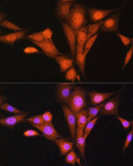 Immunocytochemistry/ Immunofluorescence ASNA1 Antibody