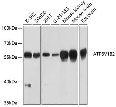 Western Blot: ATP6V1B2 Antibody [NBP3-38048] - Western blot analysis of various lysates using ATP6V1B2 Rabbit pAb at 1:1000 dilution.Secondary antibody: HRP-conjugated Goat anti-Rabbit IgG (H+L) at 1:10000 dilution.Lysates/proteins: 25ug per lane.Blocking buffer: 3% nonfat dry milk in TBST.Detection: ECL Basic Kit.Exposure time: 30s.
