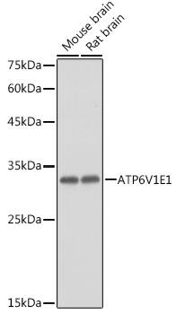 Western Blot: ATP6V1E1 Antibody [NBP3-38049] - Western blot analysis of various lysates using ATP6V1E1 Rabbit pAb at 1:1000 dilution.Secondary antibody: HRP-conjugated Goat anti-Rabbit IgG (H+L) at 1:10000 dilution.Lysates/proteins: 25ug per lane.Blocking buffer: 3% nonfat dry milk in TBST.Detection: ECL Basic Kit.Exposure time: 1s.