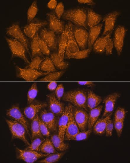 Immunocytochemistry/ Immunofluorescence: ATP6V1E1 Antibody [NBP3-38049] - Immunofluorescence analysis of HeLa cells using ATP6V1E1 Rabbit pAb at dilution of 1:100. Secondary antibody: Cy3-conjugated Goat anti-Rabbit IgG (H+L) at 1:500 dilution. Blue: DAPI for nuclear staining.