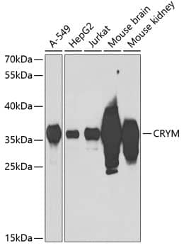 Western Blot: mu Crystallin Antibody [NBP3-38052] - Western blot analysis of various lysates using mu Crystallin Rabbit pAb at 1:1000 dilution.Secondary antibody: HRP-conjugated Goat anti-Rabbit IgG (H+L) at 1:10000 dilution.Lysates/proteins: 25ug per lane.Blocking buffer: 3% nonfat dry milk in TBST.Detection: ECL Basic Kit.Exposure time: 90s.