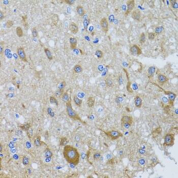 Immunohistochemistry DNCIC1 Antibody - BSA Free