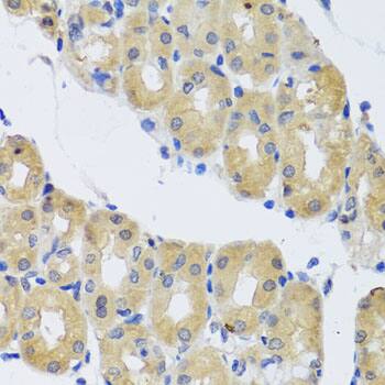 Immunohistochemistry: DNCIC1 Antibody [NBP3-38053] - Immunohistochemistry analysis of paraffin-embedded Human stomach using DNCIC1 Rabbit pAb at dilution of 1:100 (40x lens). Microwave antigen retrieval performed with 0.01M PBS Buffer (pH 7.2) prior to IHC staining.