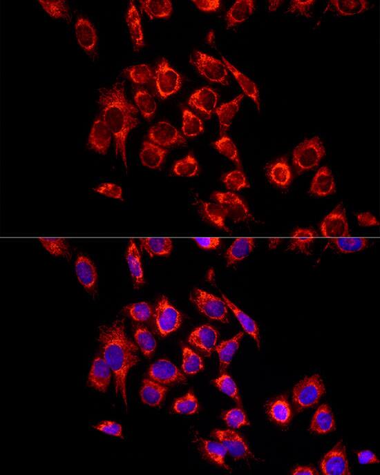 Immunocytochemistry/ Immunofluorescence: ECHS1 Antibody [NBP3-38054] - Immunofluorescence analysis of HeLa cells using ECHS1 Rabbit pAb at dilution of 1:100 (40x lens). Secondary antibody: Cy3-conjugated Goat anti-Rabbit IgG (H+L) at 1:500 dilution. Blue: DAPI for nuclear staining.