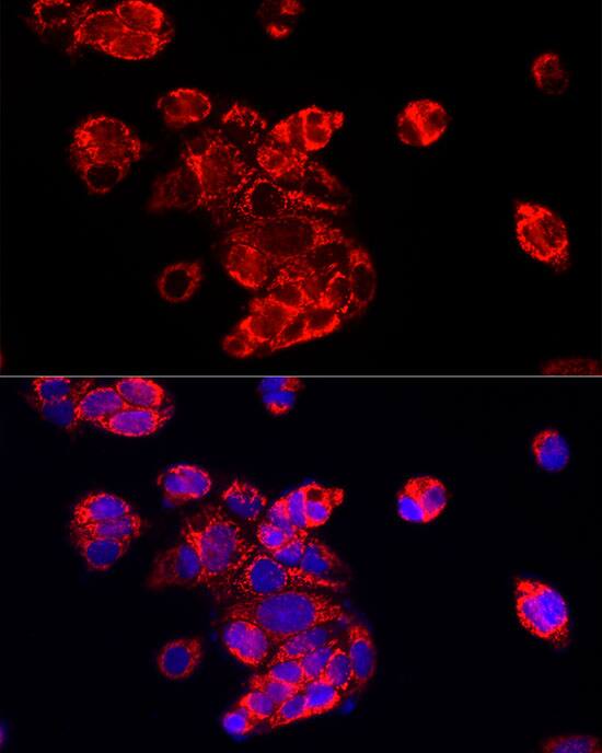 Immunocytochemistry/ Immunofluorescence: ECHS1 Antibody [NBP3-38054] - Immunofluorescence analysis of MCF7 cells using ECHS1 Rabbit pAb at dilution of 1:100 (40x lens). Secondary antibody: Cy3-conjugated Goat anti-Rabbit IgG (H+L) at 1:500 dilution. Blue: DAPI for nuclear staining.