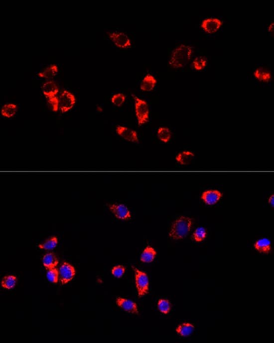 Immunocytochemistry/ Immunofluorescence: ECHS1 Antibody [NBP3-38054] - Immunofluorescence analysis of NIH/3T3 cells using ECHS1 Rabbit pAb at dilution of 1:100 (40x lens). Secondary antibody: Cy3-conjugated Goat anti-Rabbit IgG (H+L) at 1:500 dilution. Blue: DAPI for nuclear staining.