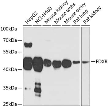 Western Blot: Ferredoxin Reductase Antibody [NBP3-38055] - Western blot analysis of various lysates using Ferredoxin Reductase Rabbit pAb at 1:1000 dilution.Secondary antibody: HRP-conjugated Goat anti-Rabbit IgG (H+L) at 1:10000 dilution.Lysates/proteins: 25ug per lane.Blocking buffer: 3% nonfat dry milk in TBST.Detection: ECL Enhanced Kit.Exposure time: 30s.