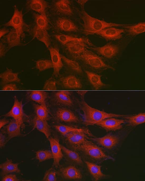 Immunocytochemistry/ Immunofluorescence: GART Antibody [NBP3-38056] - Immunofluorescence analysis of C6 cells using GART Rabbit pAb at dilution of 1:200 (40x lens). Secondary antibody: Cy3-conjugated Goat anti-Rabbit IgG (H+L) at 1:500 dilution. Blue: DAPI for nuclear staining.