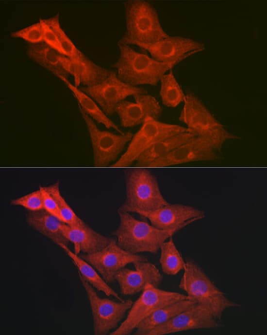 Immunocytochemistry/ Immunofluorescence: GART Antibody [NBP3-38056] - Immunofluorescence analysis of NIH-3T3 cells using GART Rabbit pAb at dilution of 1:200 (40x lens). Secondary antibody: Cy3-conjugated Goat anti-Rabbit IgG (H+L) at 1:500 dilution. Blue: DAPI for nuclear staining.