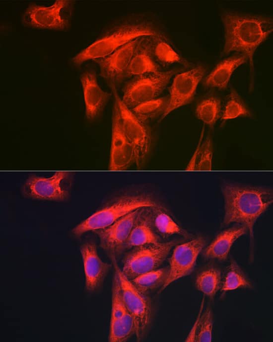 Immunocytochemistry/ Immunofluorescence: GART Antibody [NBP3-38056] - Immunofluorescence analysis of U-2 OS cells using GART Rabbit pAb at dilution of 1:200 (40x lens). Secondary antibody: Cy3-conjugated Goat anti-Rabbit IgG (H+L) at 1:500 dilution. Blue: DAPI for nuclear staining.