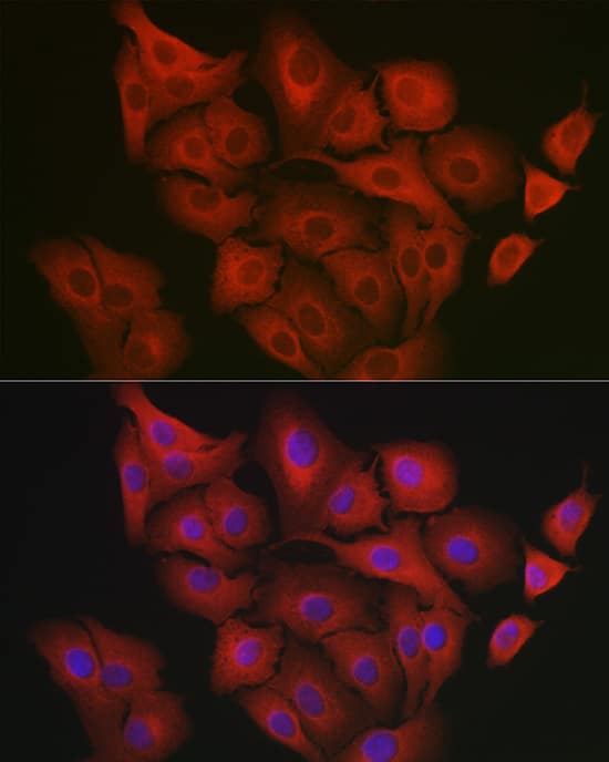 Immunocytochemistry/ Immunofluorescence: GART Antibody [NBP3-38056] - Immunofluorescence analysis of A549 cells using GART Rabbit pAb at dilution of 1:200 (40x lens). Secondary antibody: Cy3-conjugated Goat anti-Rabbit IgG (H+L) at 1:500 dilution. Blue: DAPI for nuclear staining.