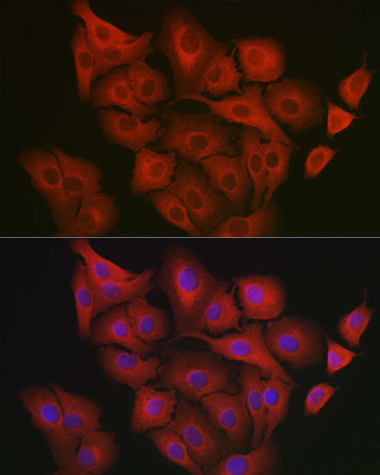 Immunocytochemistry/ Immunofluorescence: GART Antibody [NBP3-38056] - Immunofluorescence analysis of A549 cells using GART Rabbit pAb at dilution of 1:200 (40x lens). Blue: DAPI for nuclear staining.